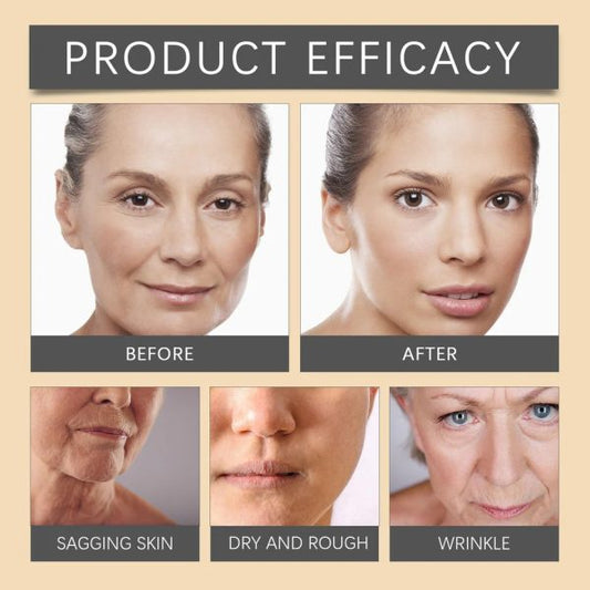 Whitening & Moisturizing Bee Venom Facial Care Cream – Brightening, Anti-aging, Hydrating Face Moisturizer For Radiant, Smooth & Youthful Skin
